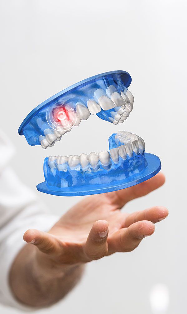 3D-Implantatplanung